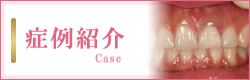 症例紹介